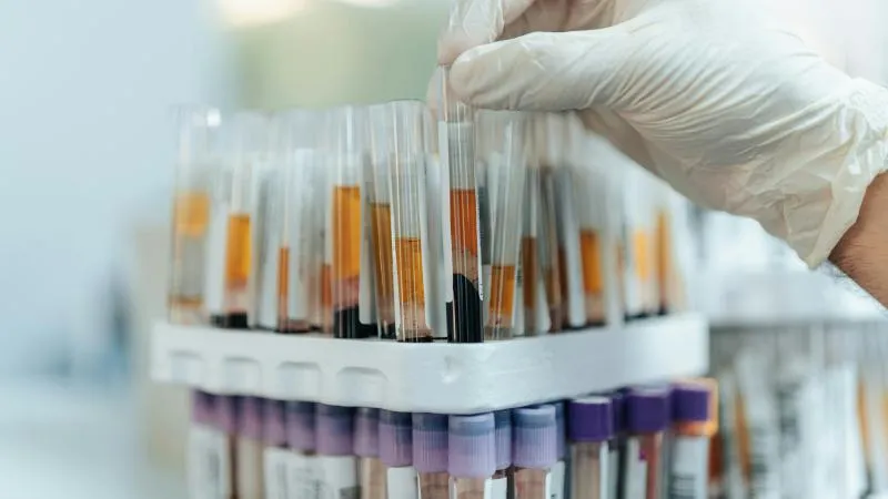 Chronic Leukemia: types and treatment