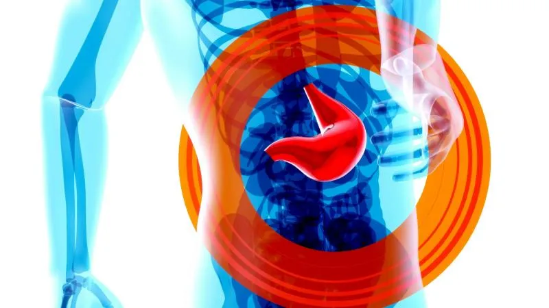 Mini Gastric Bypass Surgery
