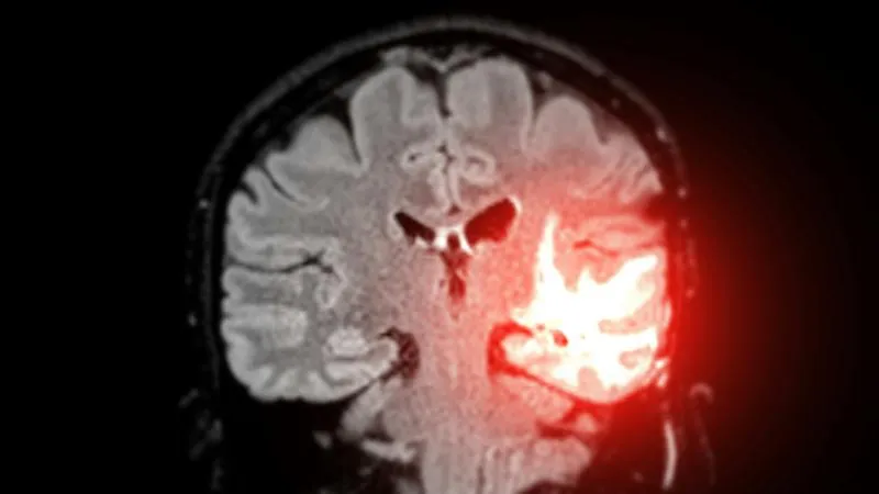 Brain Tumor Surgery - Brain Tumor Removal