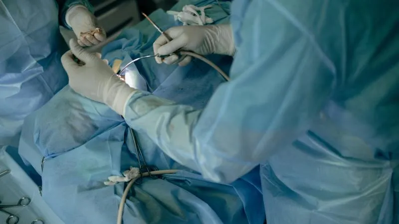 Laparoscopic Prostatectomy