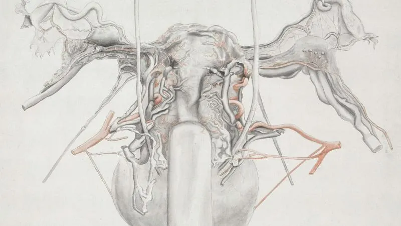 Varicocelectomy - Varicocele Surgery
