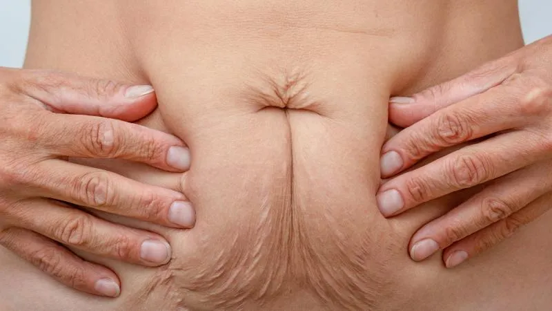 Hernia Repair Surgery