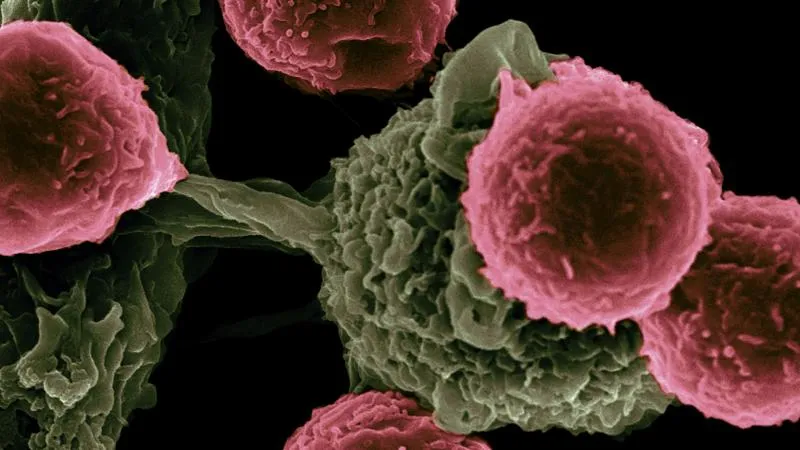Bone Marrow Transplant For Leukemia