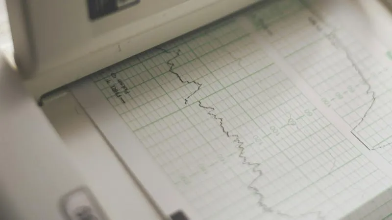 Cardiac ICU (Cardiac Intensive Care Unit)