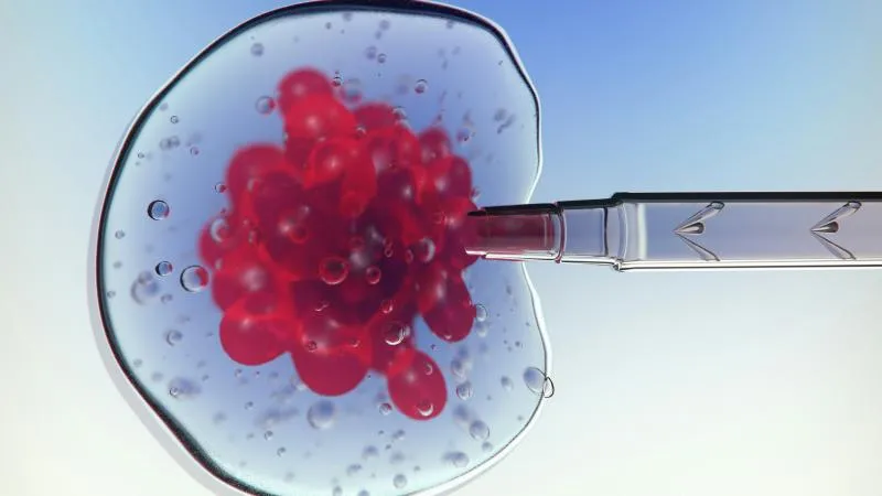 Autologous Stem Cell Transplant