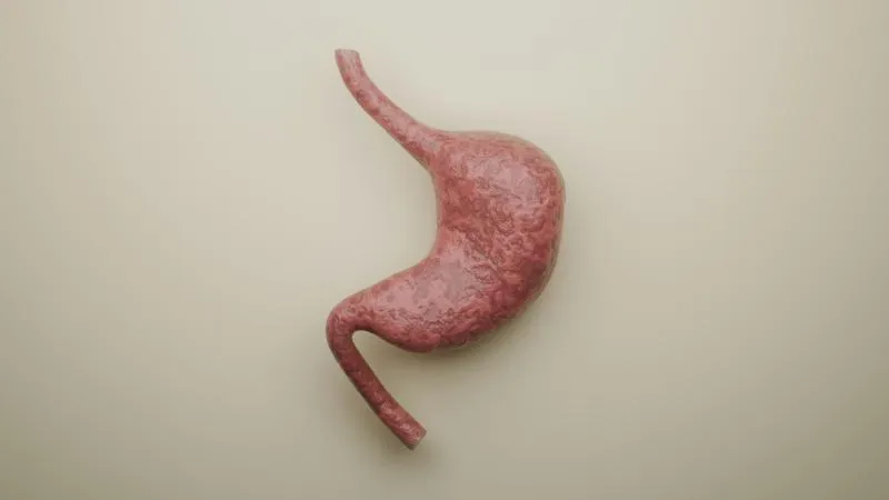 Barrett's Esophagus Treatment
