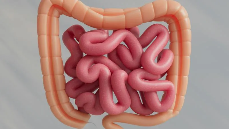 Colorectal Polyp Removal