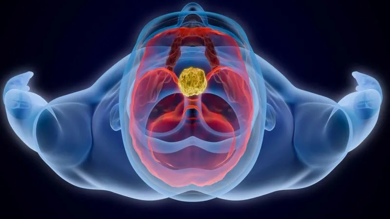 Brain Tumor Radiation Therapy