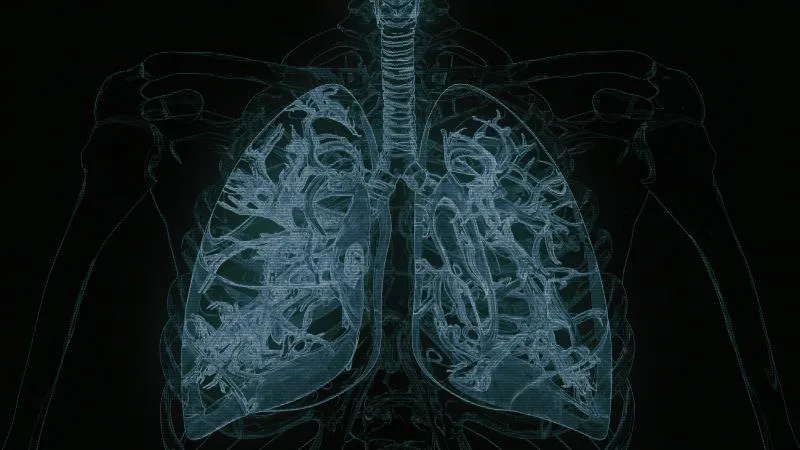Lung Cancer Radiation Therapy