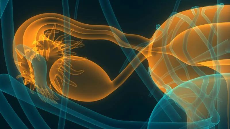 Cervical Cancer Radiation Therapy