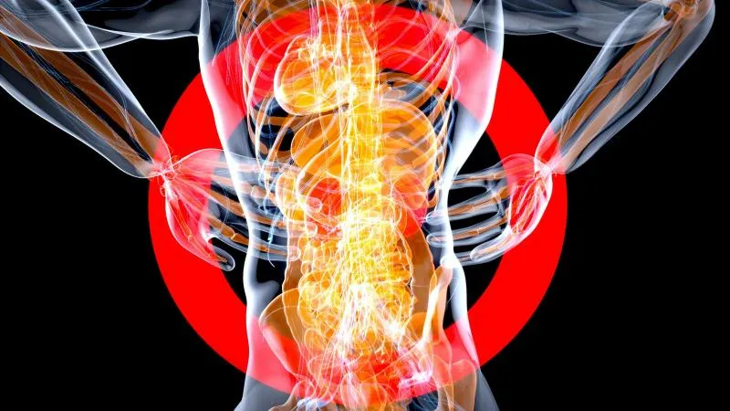 Spine Metastasis Radiation Therapy