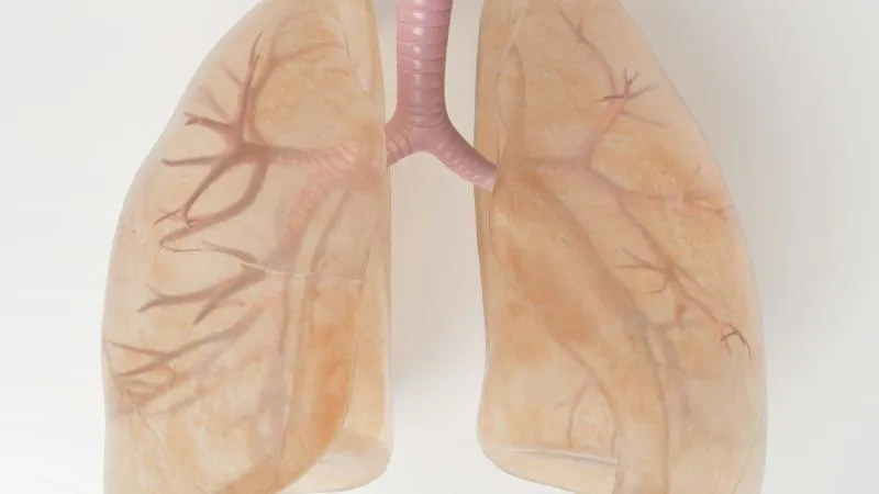 Lobectomy - Lung Lobe Removal Surgery
