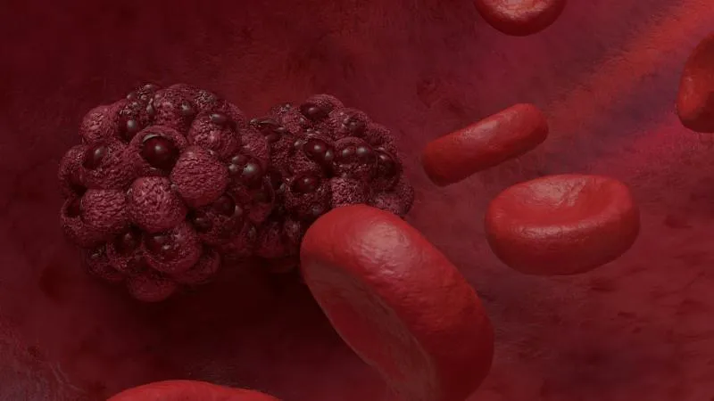 Tumor Embolization
