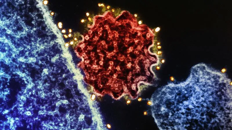 Nivolumab Therapy - Opdivo