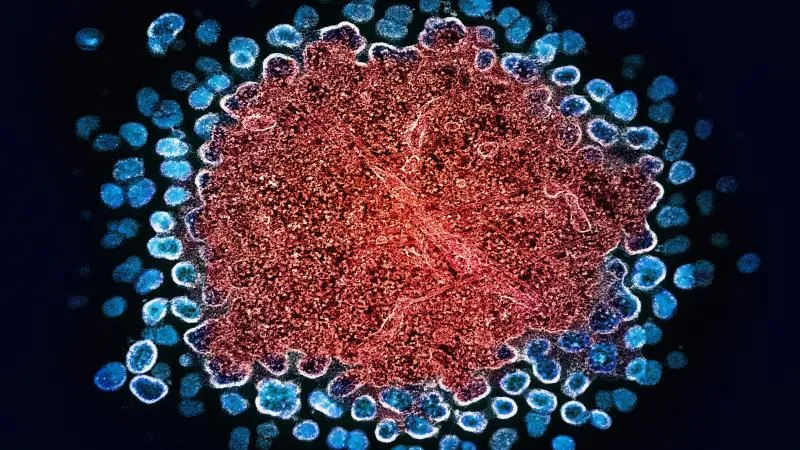Sacituzumab Govitecan Therapy - Trodelvy