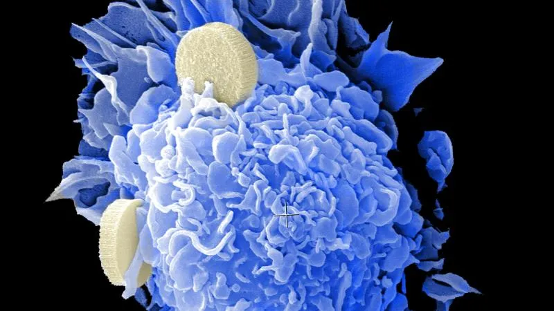 Smart Drugs For Cancer - Targeted Therapy