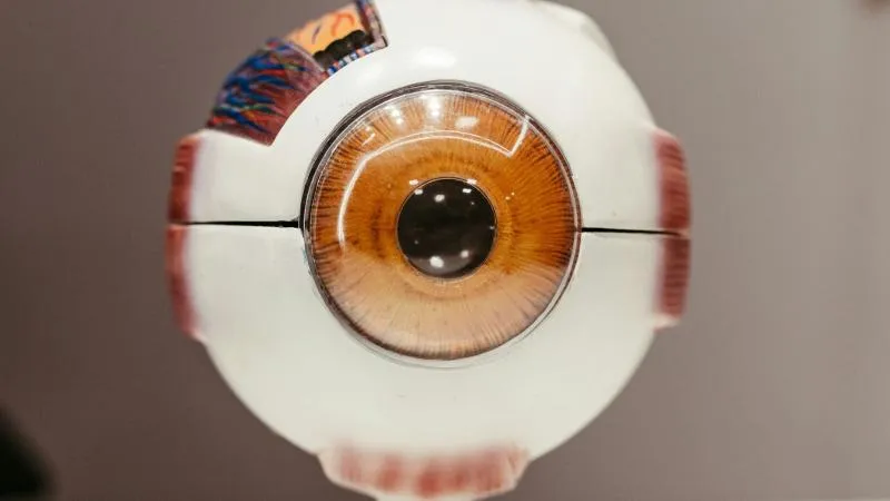 Cataract Surgery