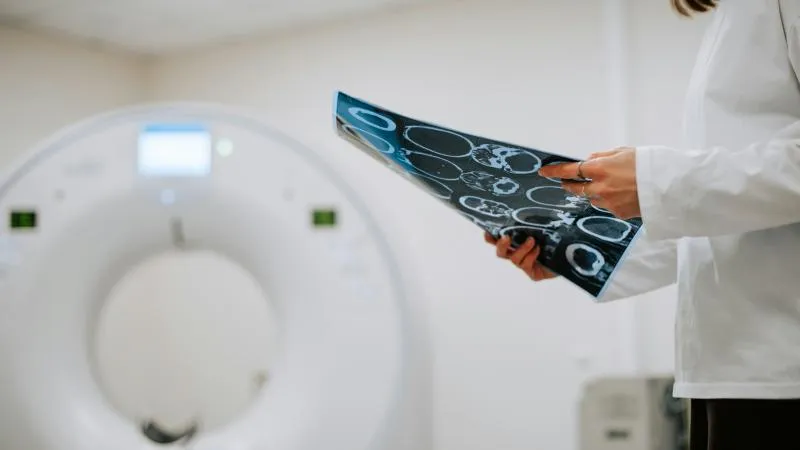 PSMA PET/CT Scan - Prostate Cancer Imaging