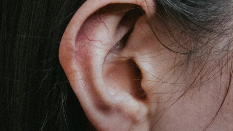 Otoplasty