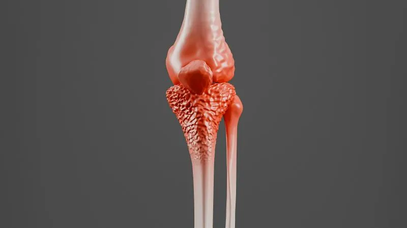 Orthopedic Oncology Surgery