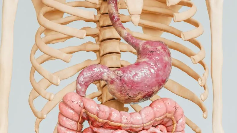 Gastric Cancer Surgery - Stomach Cancer Surgery