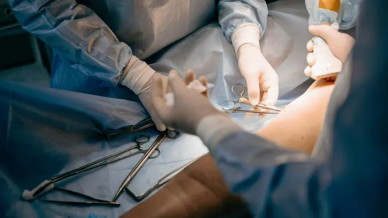 Free Flap Reconstruction
