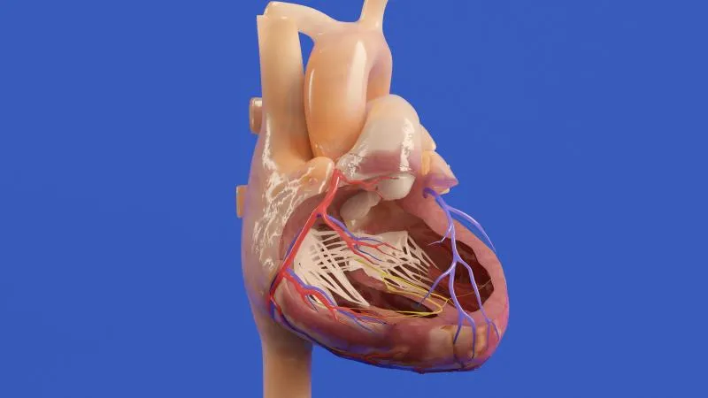 Mitral Valve Replacement
