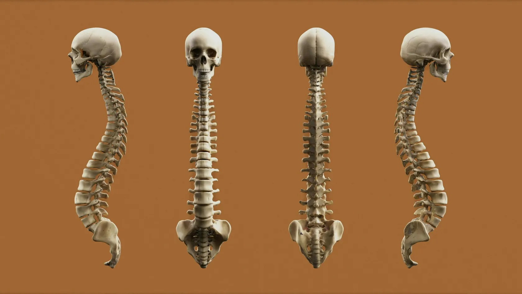 Spinal Fusion Surgery - Vertebrae Fusion Surgery