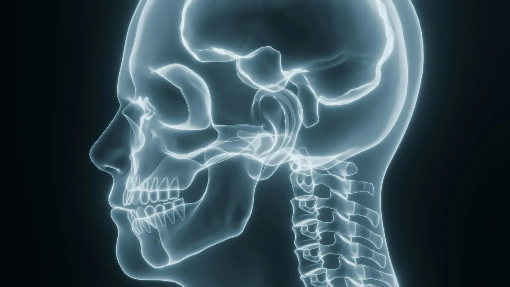 Chiari Malformation Surgery