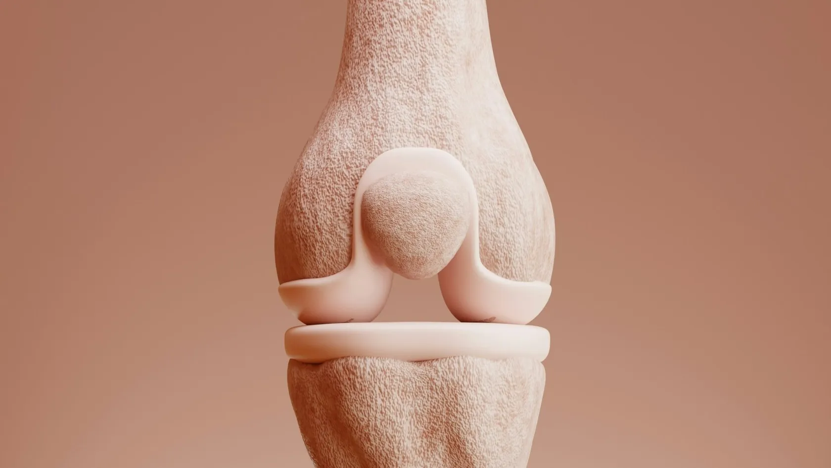 Kyphoplasty