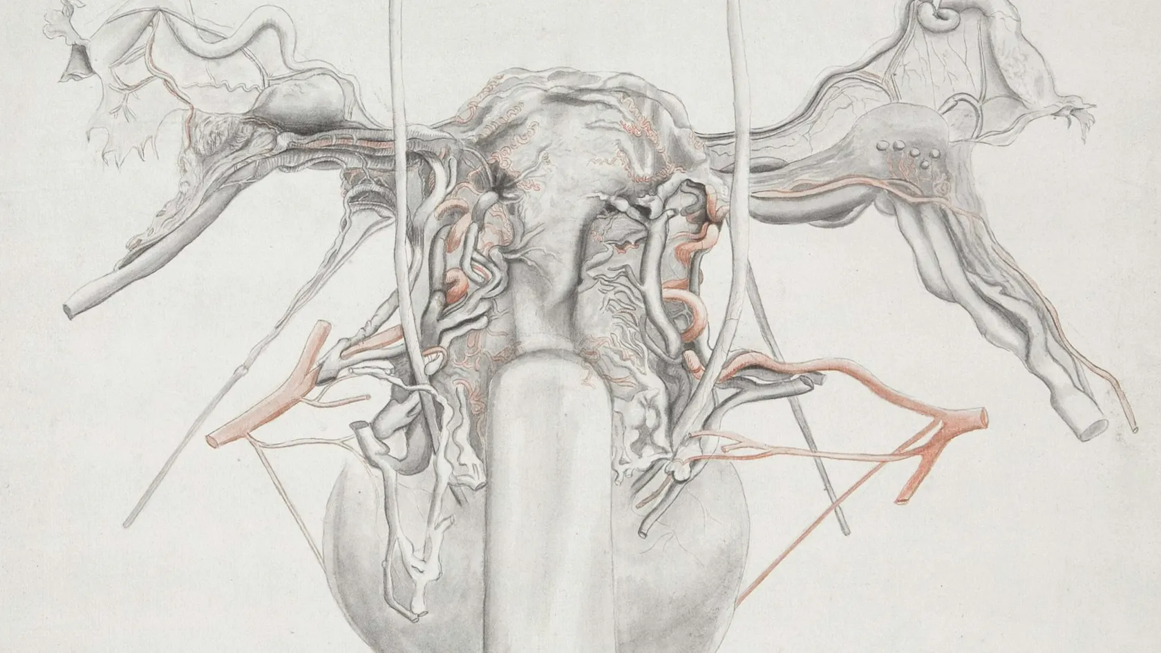 Varicocelectomy - Varicocele Surgery