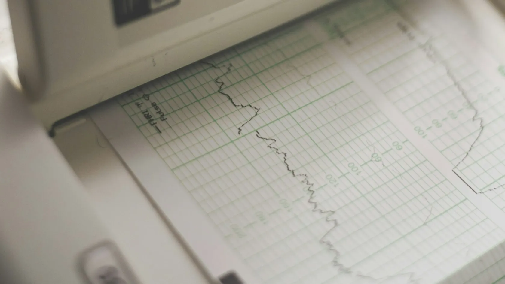 Cardiac ICU (Cardiac Intensive Care Unit)