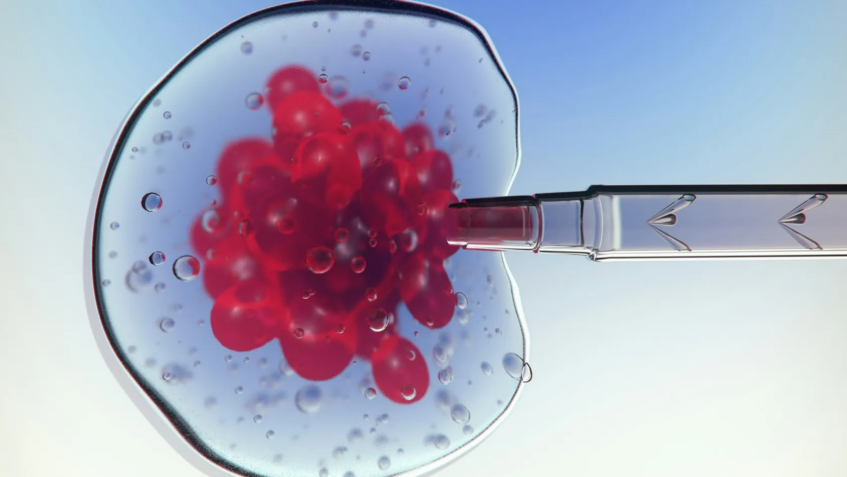Autologous Stem Cell Transplant