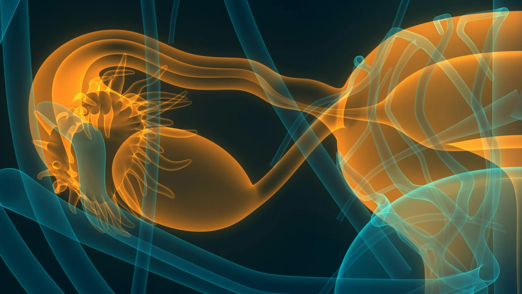 Cervical Cancer Radiation Therapy