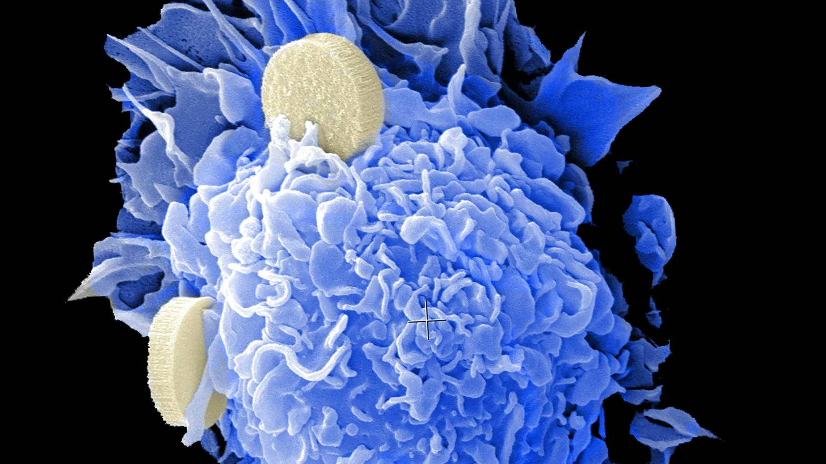 Smart Drugs For Cancer - Targeted Therapy