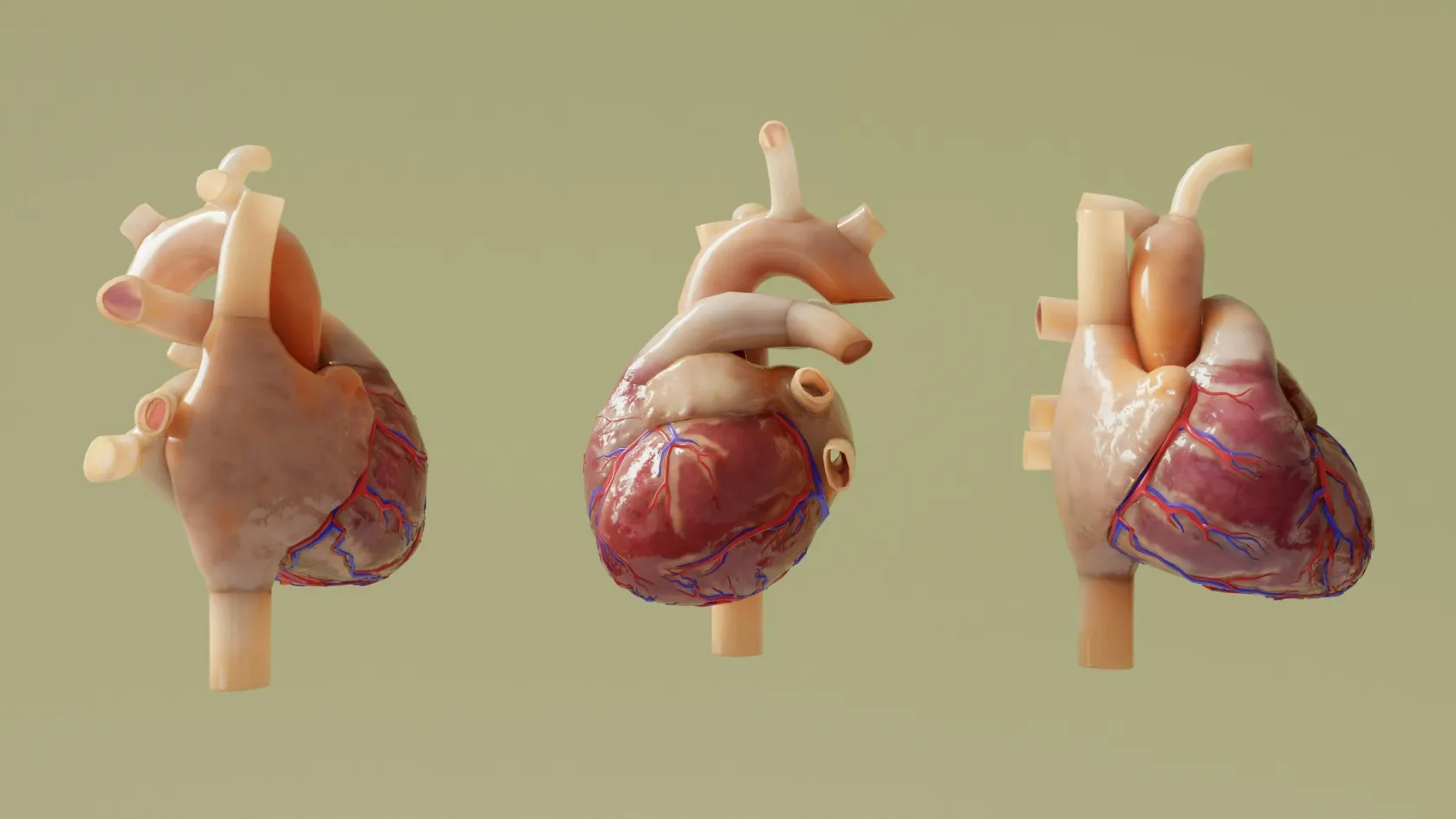 Mitral Valve Repair
