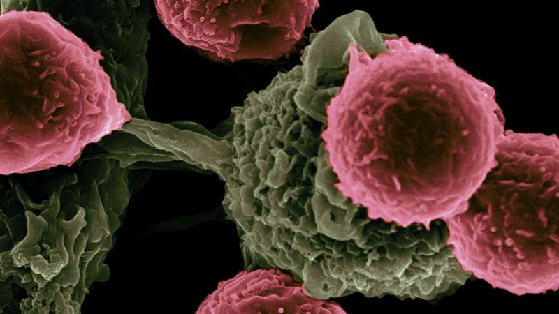 Why does lymphoma occur? causes and contributing factors