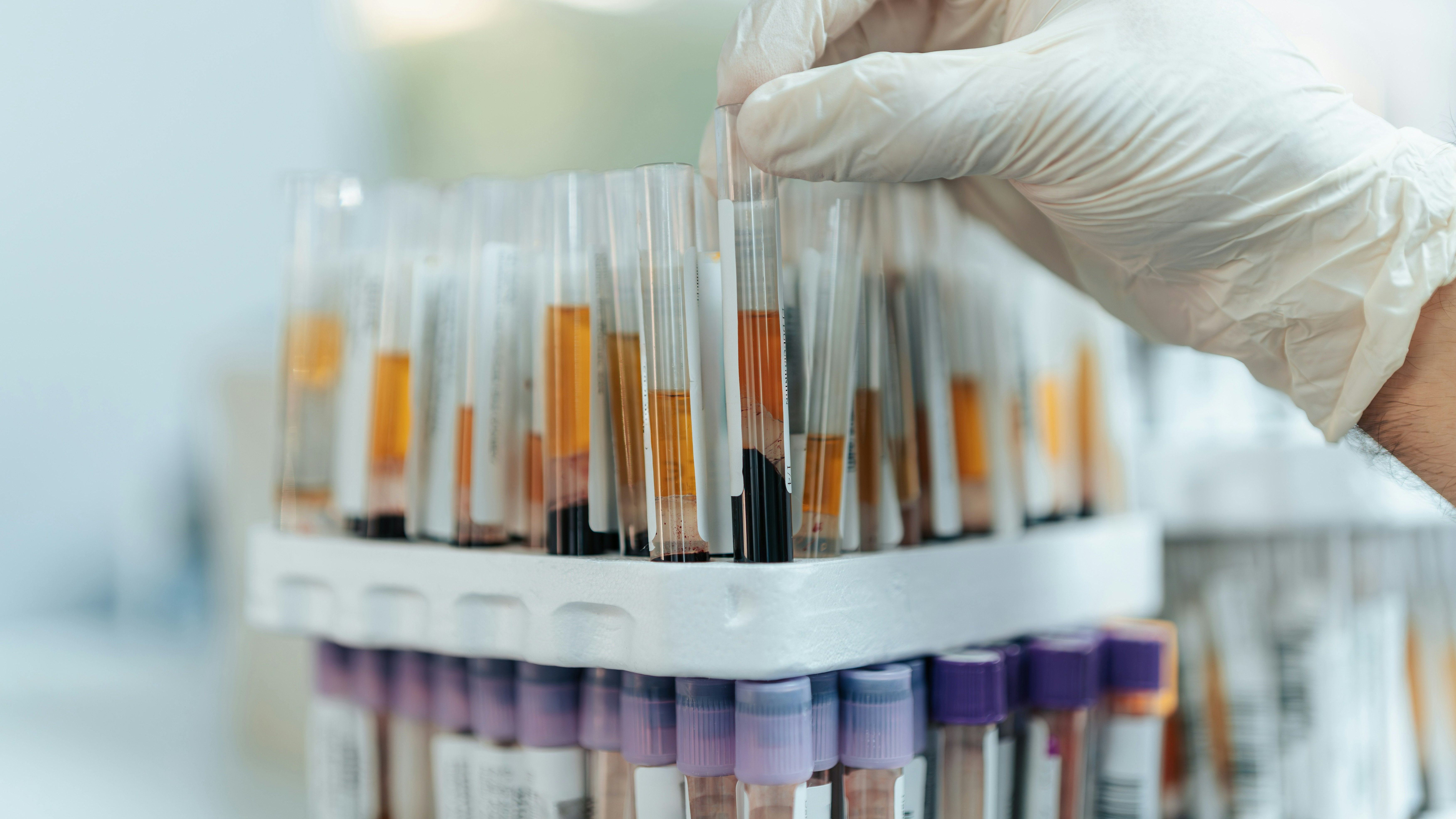 Chronic Leukemia: types and treatment