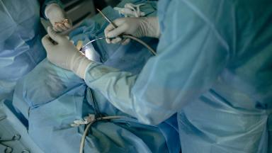 Laparoscopic Prostatectomy