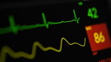 Cardiac Care Unit (CCU)