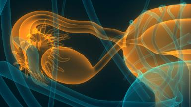 Cervical Cancer Radiation Therapy