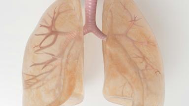 Lobectomy - Lung Lobe Removal Surgery