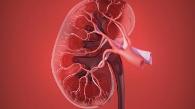 Kidney Transplant Surgery