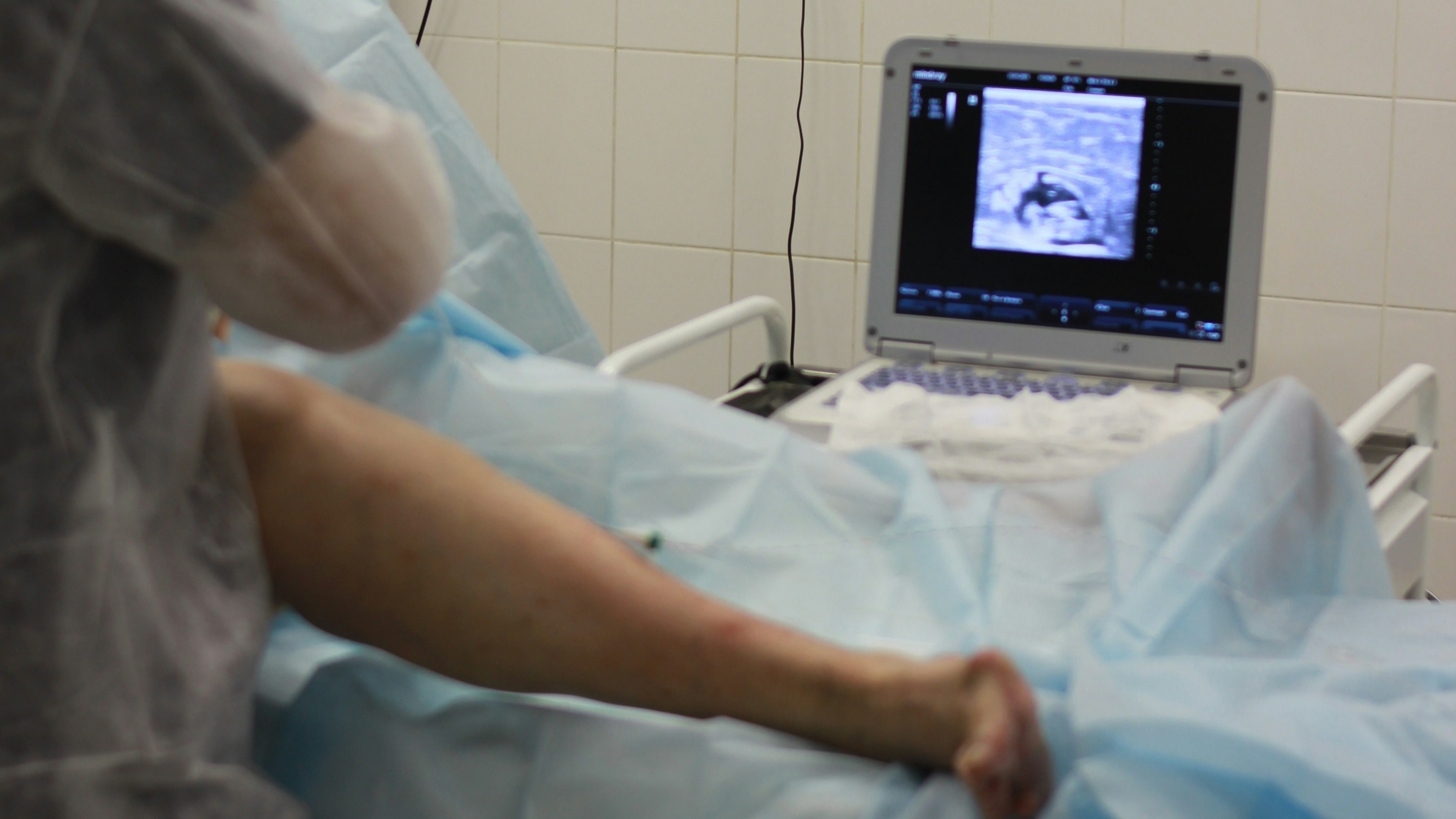 Robotic Knee Prosthesis Surgery