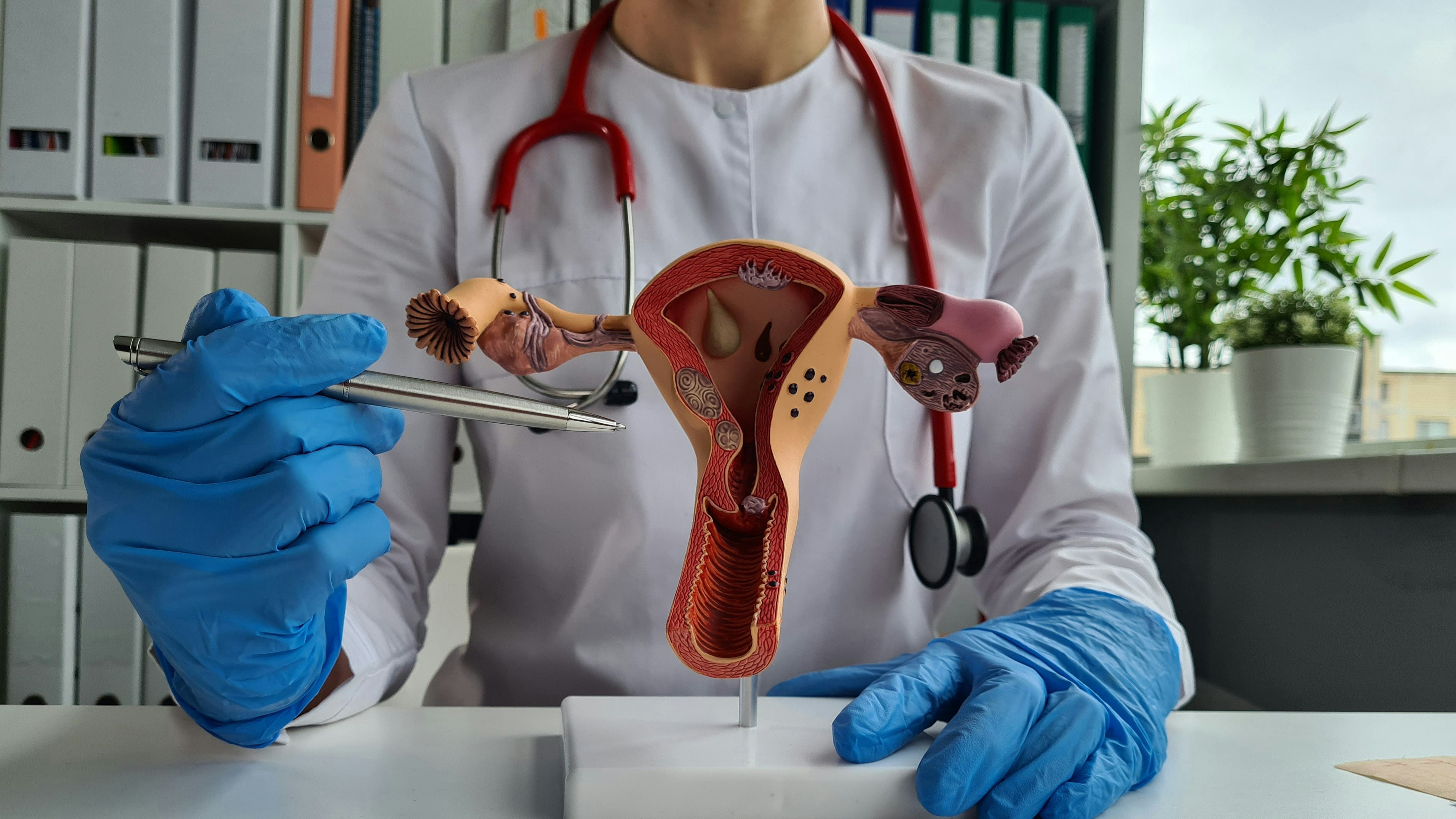 Radical Hysterectomy For Cervical Cancer