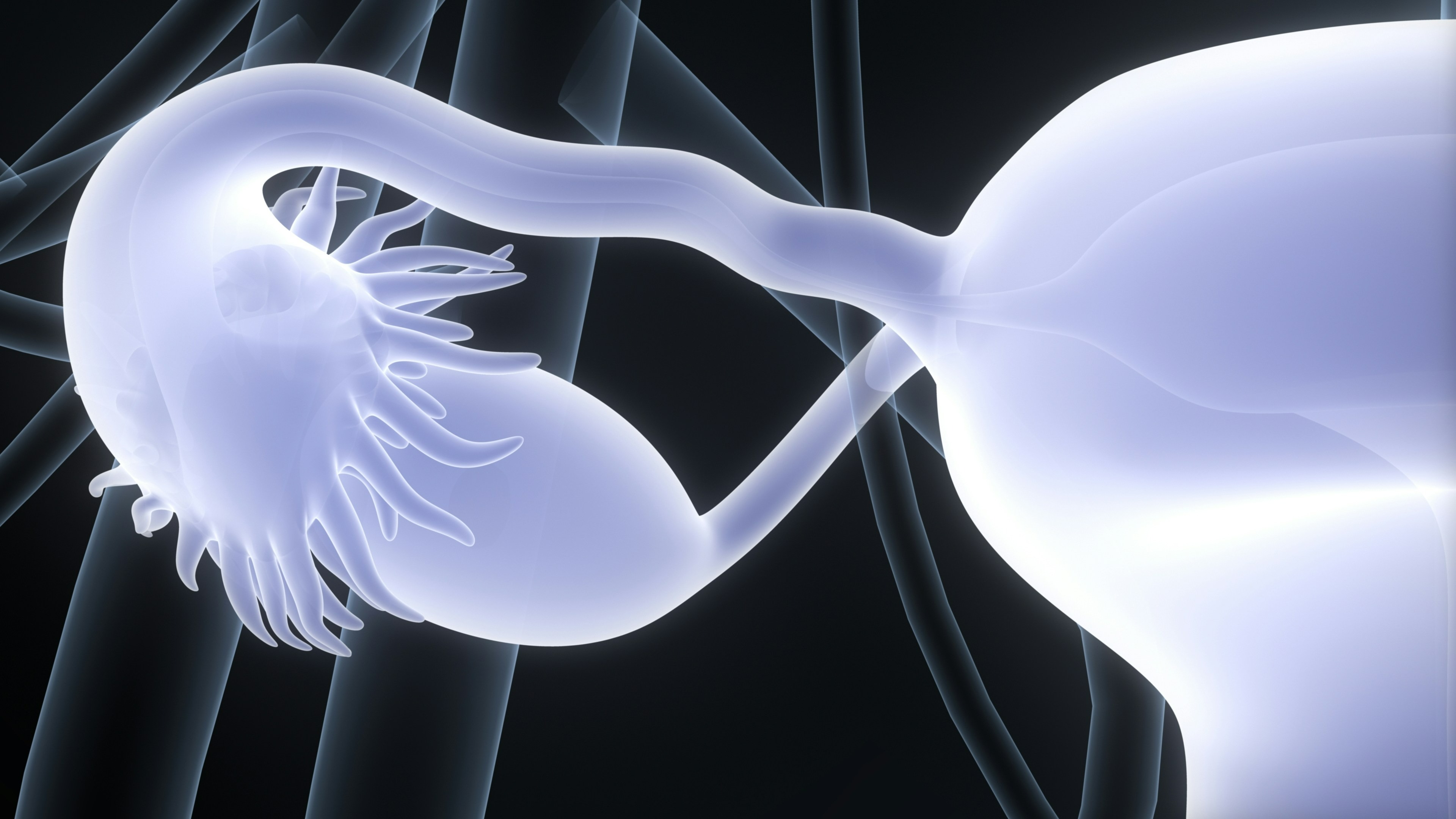Ovarian Cancer Surgery