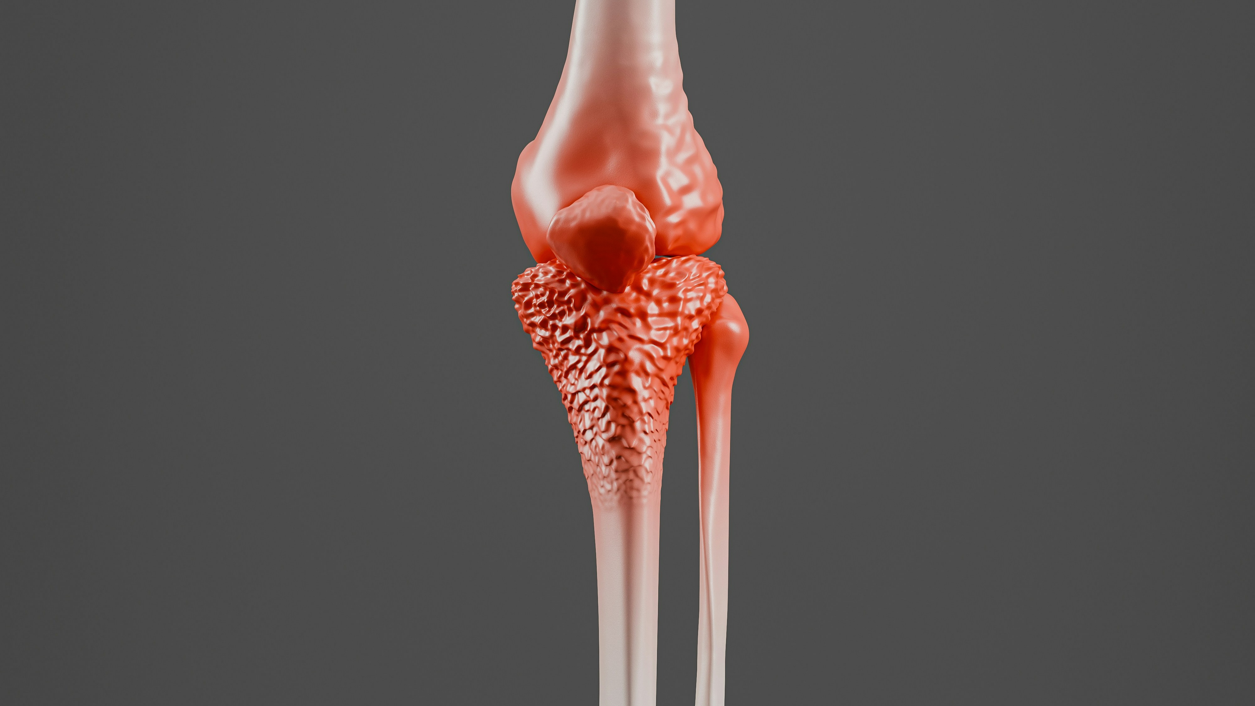 Orthopedic Oncology Surgery