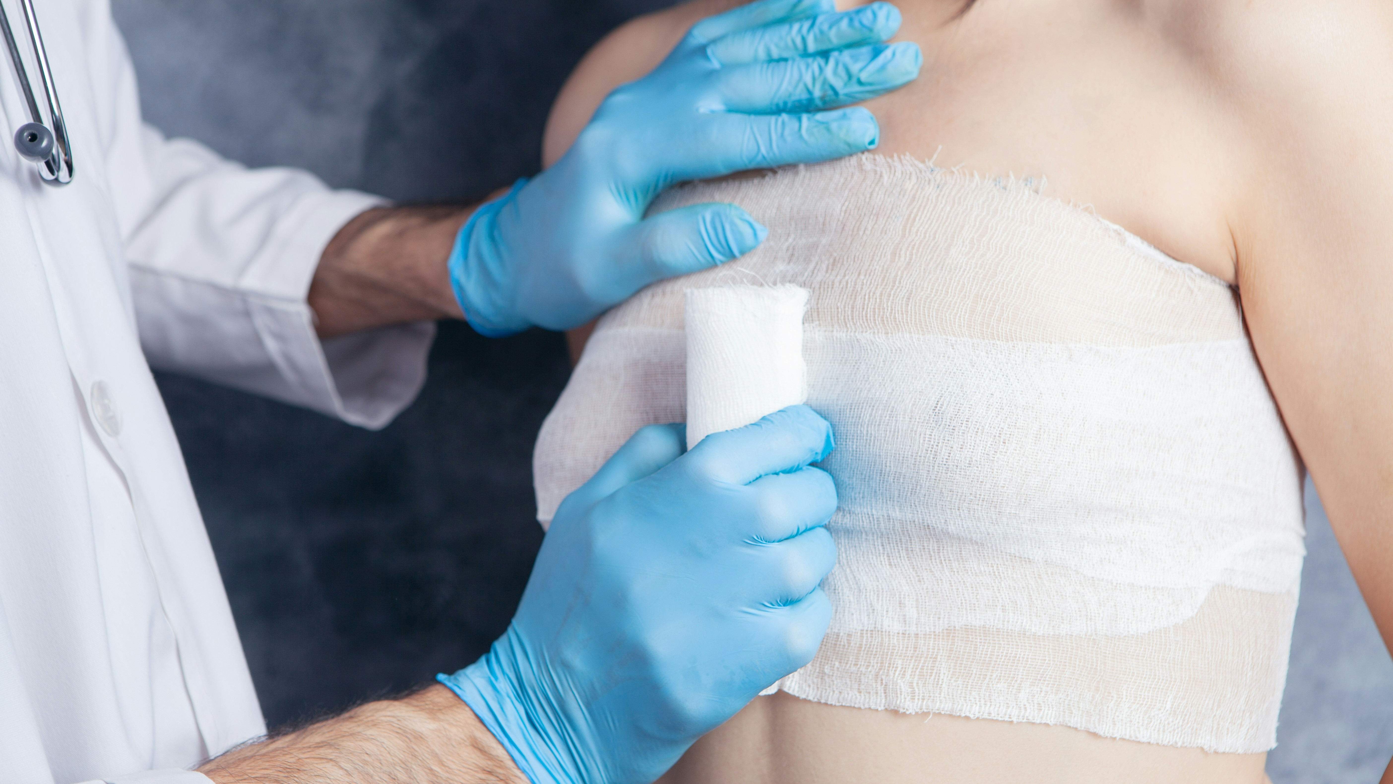 Oncoplastic Breast Surgery