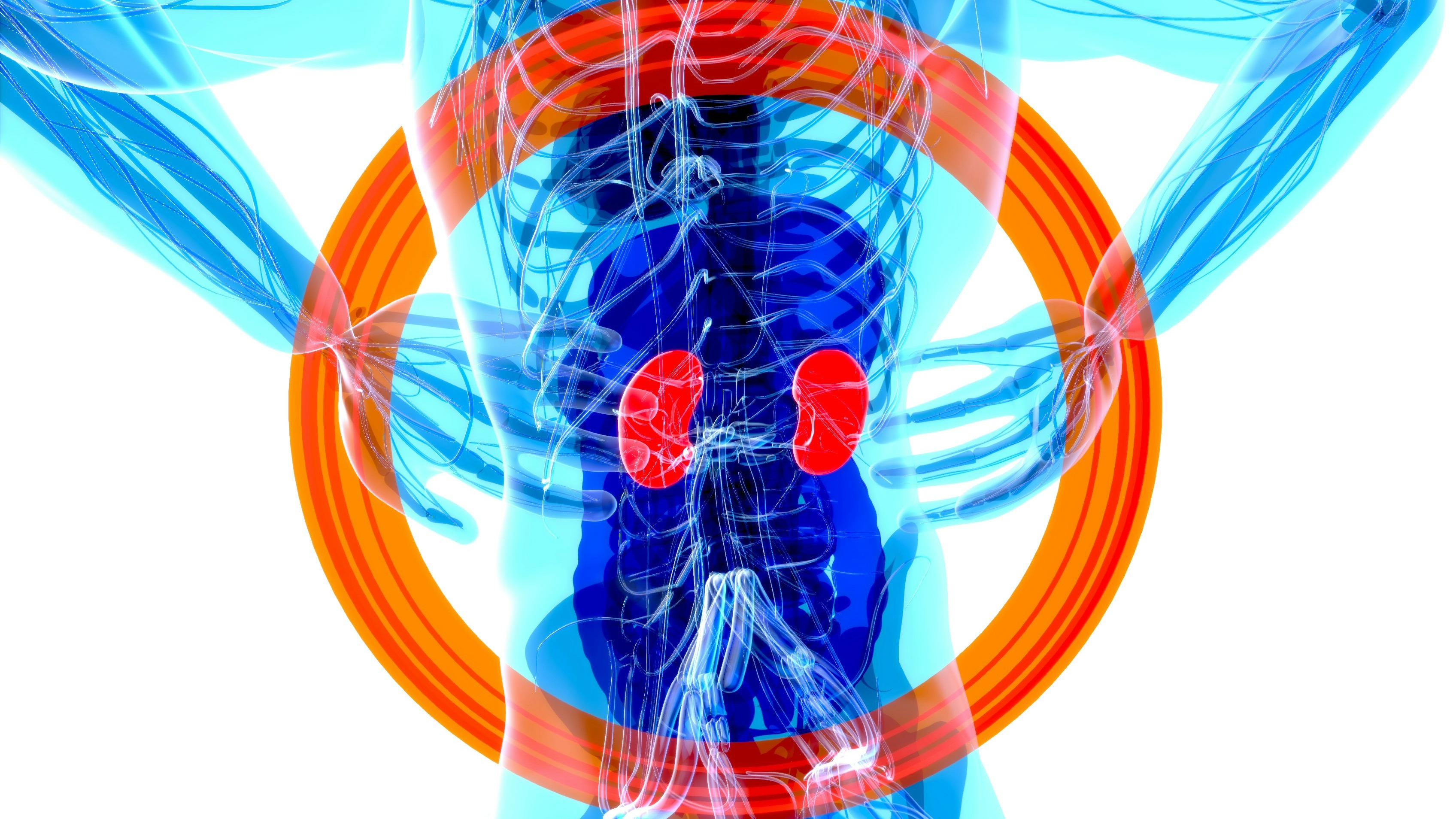 Nephrectomy - Kidney Removal Surgery