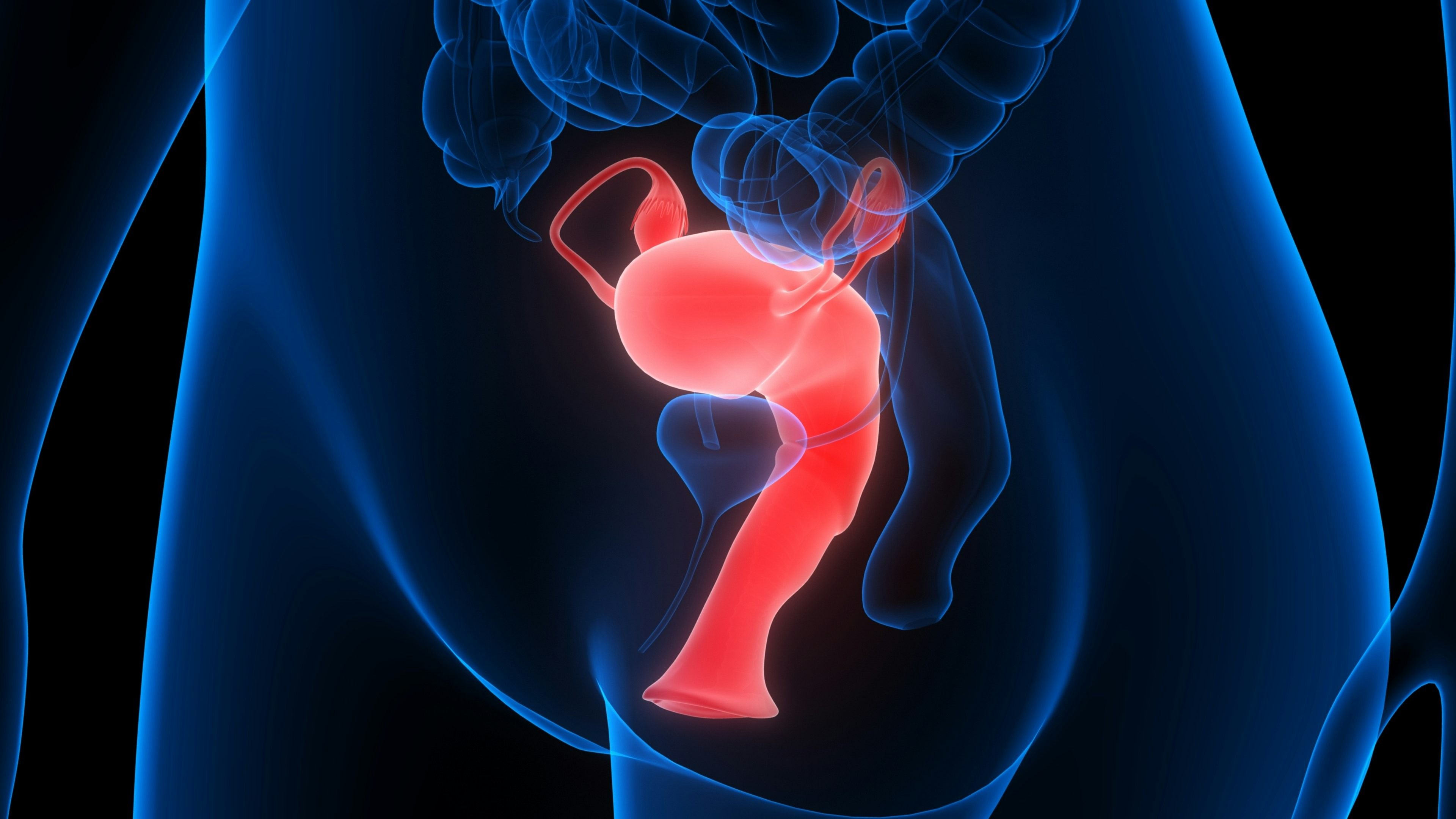 Hysterectomy For Cancer - Uterus Removal Surgery